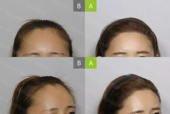 Slider image (4) MOAMAN Hair Transplant Aesthetic Restoration Clinic